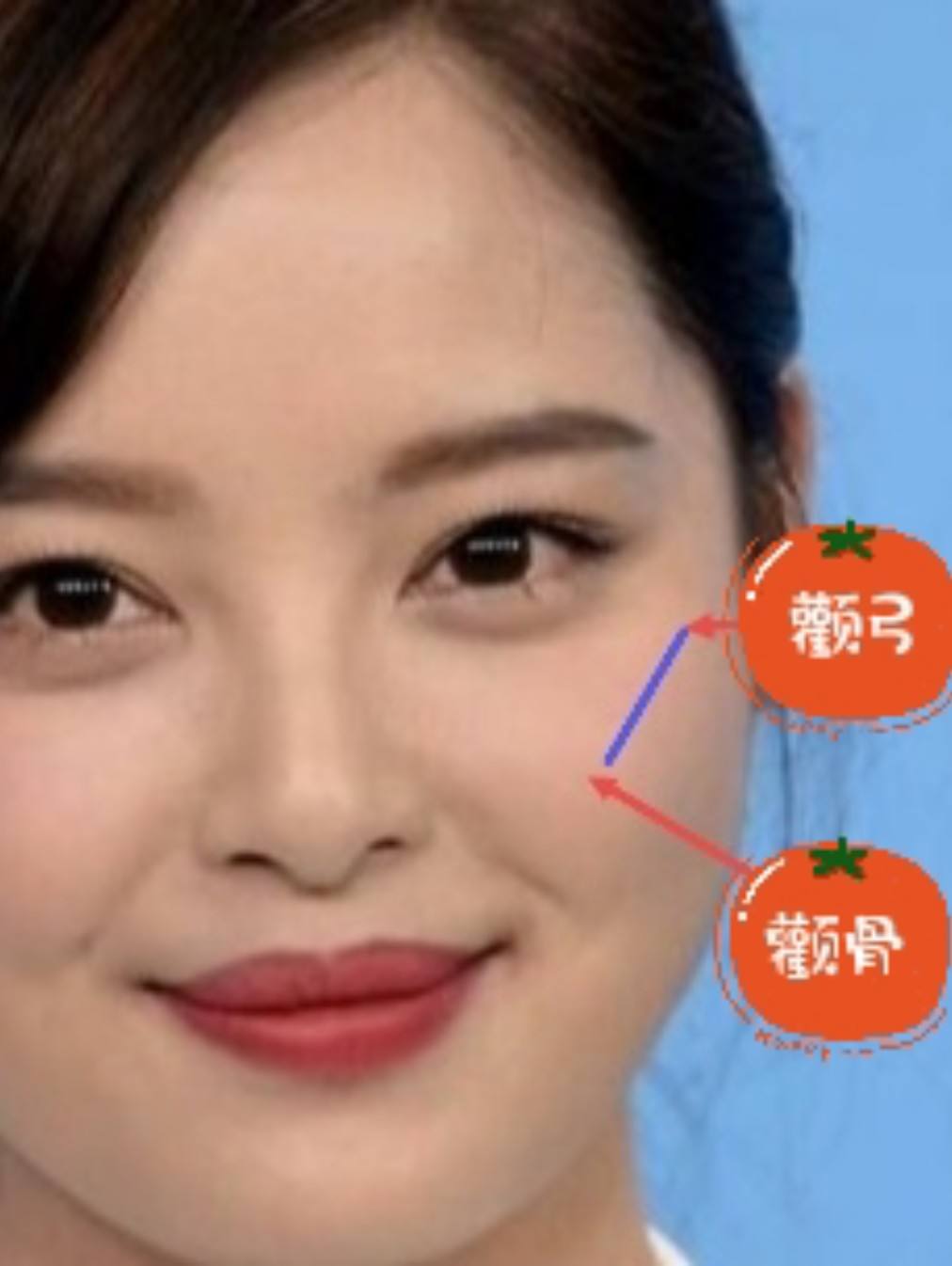 面相颧骨高