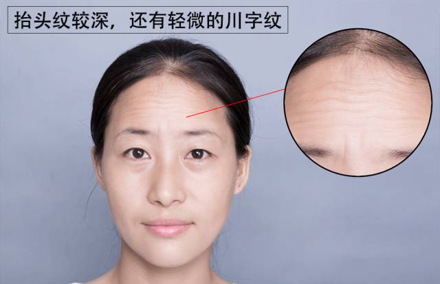 女人额头川字代表什么 女人额头中间有川字好不好