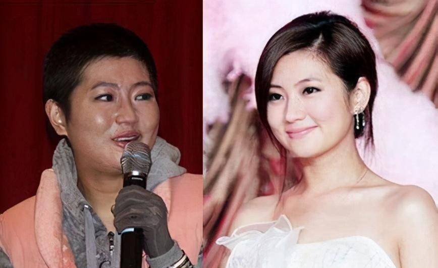 任家萱烧伤前后对比照 任家萱烧伤前的生活照